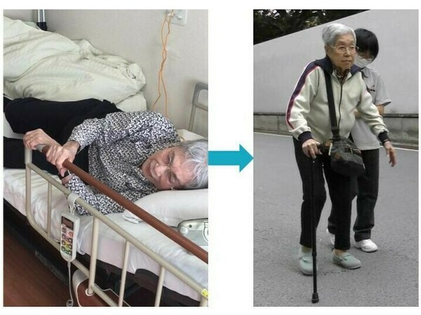 骨折して寝たきりの状態から杖を使って歩けるように